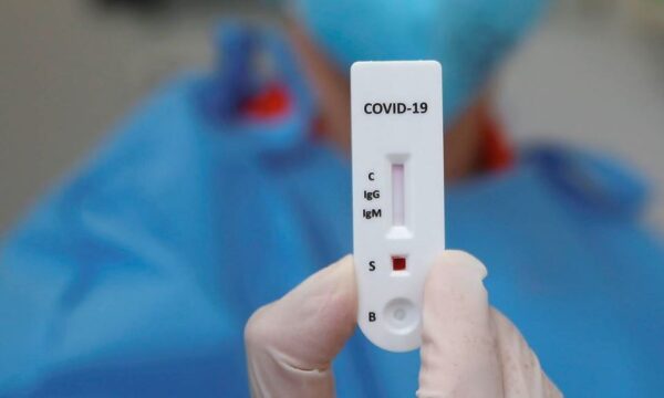Umuarama contabiliza mais 2 mortes e 95 casos da Covid-19